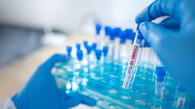 Hastane laboratuarında COVID-19 test tüpü tutan mavi steril lastik eldivenli tıp bilimci eli. Erkek doktor ya da doktor Coronavirus vakasının sonucunu alıyor. 2019-nCoV laboratuvar test konsepti