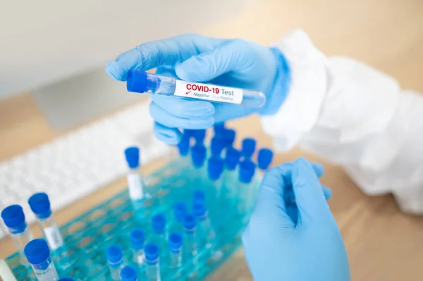 Medicinsk Videnskabsmand Hånd Med Blå Sterile Gummihandsker Holder Covid Reagensglas - Stock-foto