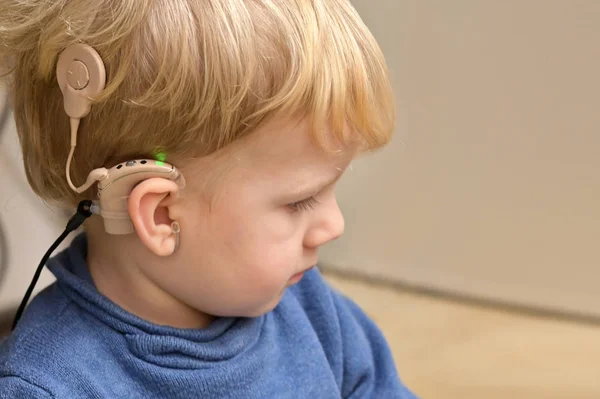 Menino com aparelhos auditivos e implantes cocleares — Fotografia de Stock