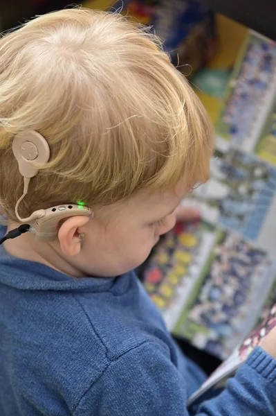 Pojke med hörapparat och Cochlear implantat Stockbild