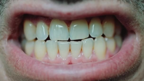Jonge mannelijke weergeven tanden. — Stockvideo