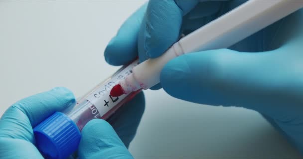 Руки микробиолога или медицинского работника в синих хирургических перчатках, маркирующих анализ крови — стоковое видео