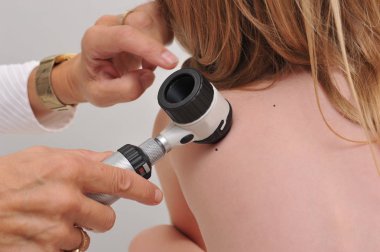 Dermatolog çocuk hasta doğum lekesi inceliyor