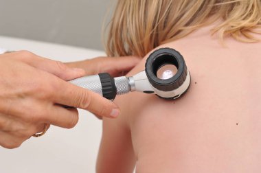 Dermatolog çocuk hasta doğum lekesi inceliyor