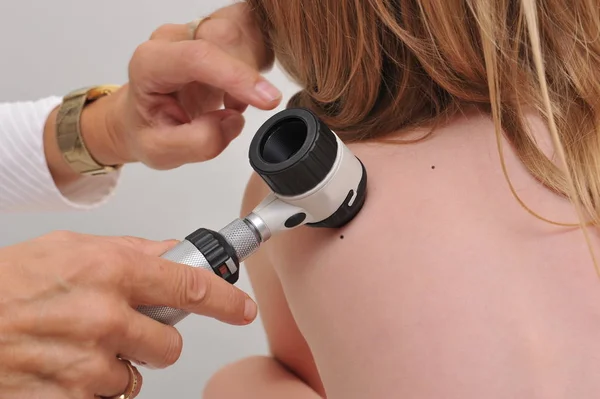 Dermatologista examina marca de nascença de paciente infantil — Fotografia de Stock