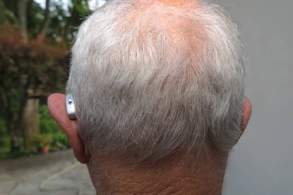 Back view of the head of a bald man with a hearing aid for the deaf or hard of hearing