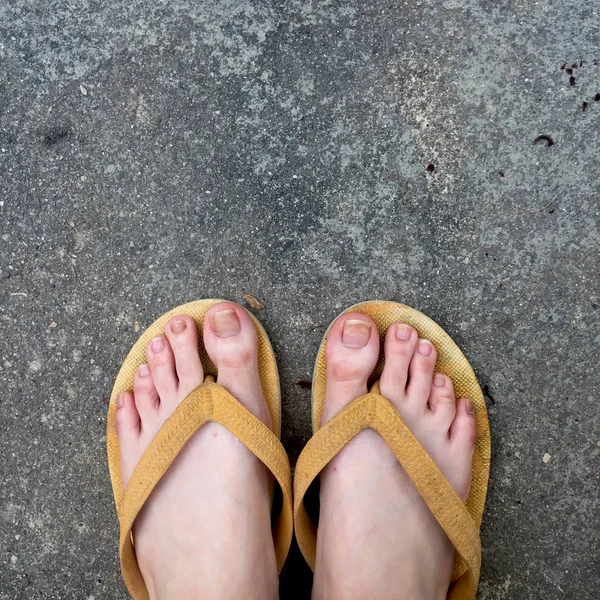 Yellow Sandals on Female Feet on Ground Background