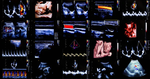 Colourful ultrasound monitor images — Stock Photo, Image