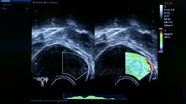 Imagens coloridas de gravidez monitor de ultra-som — Vídeo de Stock