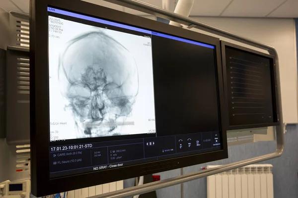Lidská hlava rentgenový obraz — Stock fotografie