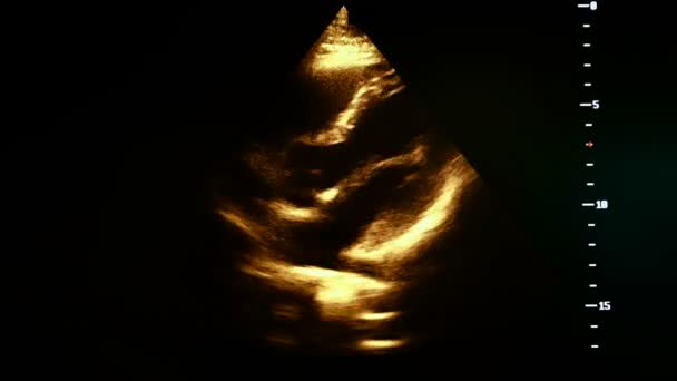 Barevné záběry z těhotenství ultrazvuk monitoru — Stock video