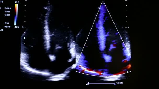 现代超声监测仪的彩色视频 超声机 高科技医疗及保健设备 超声成像技术在医学方面使用 人的心脏 四个腔室查看 — 图库视频影像