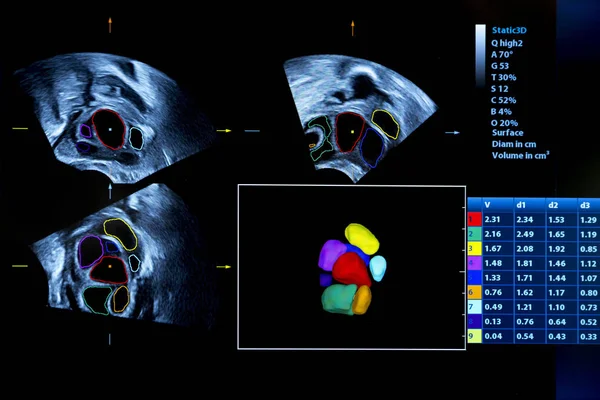 Colourful image of pregnancy ultrasound monitor — Stock Photo, Image