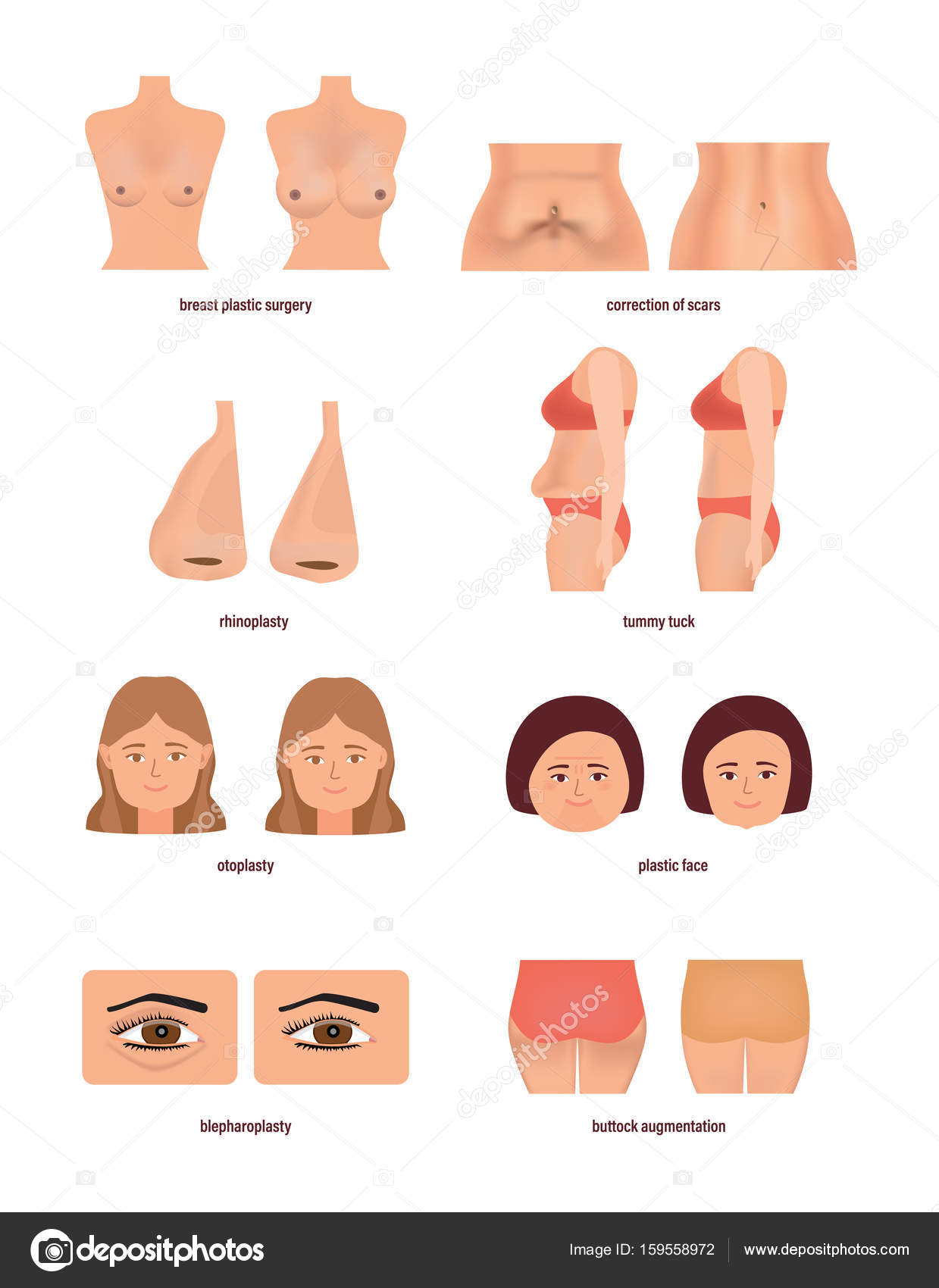 free types of plastic surgery