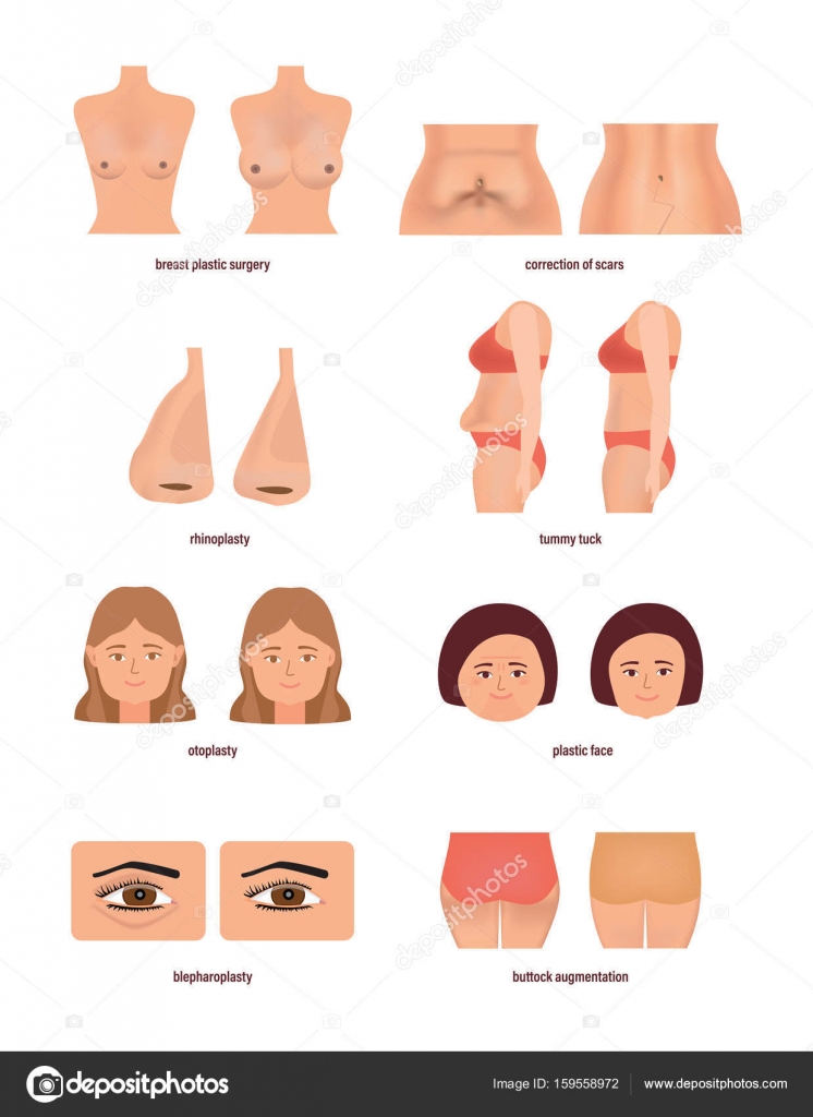 free types of plastic surgery