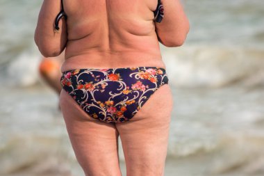 Obez Bayan arkadan görünüm.