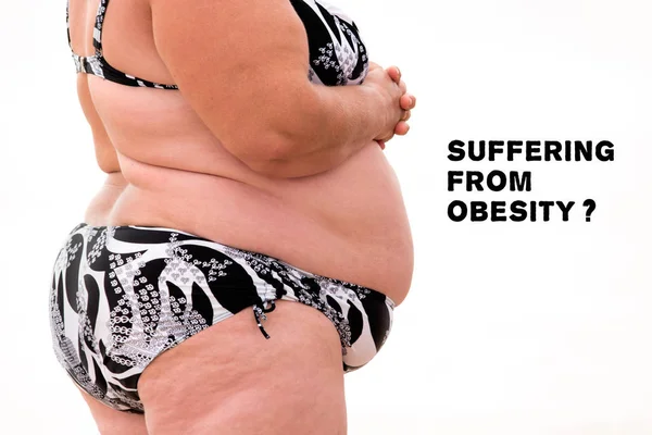 Corpo obeso isolato . — Foto Stock