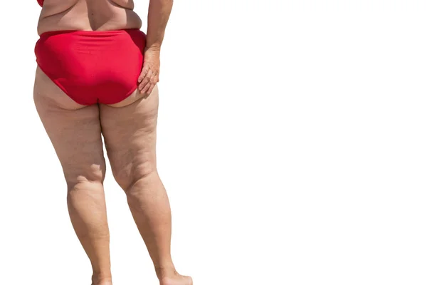 Gambe di signora obesa . — Foto Stock