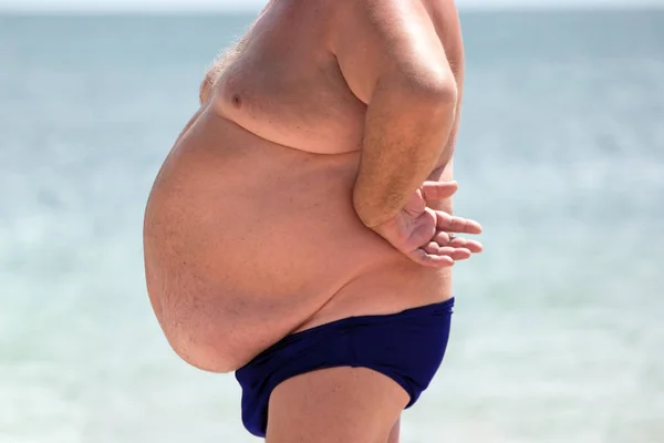 Hombre gordo playa fotos stock, imágenes de Hombre gordo playa sin royalties | Depositphotos