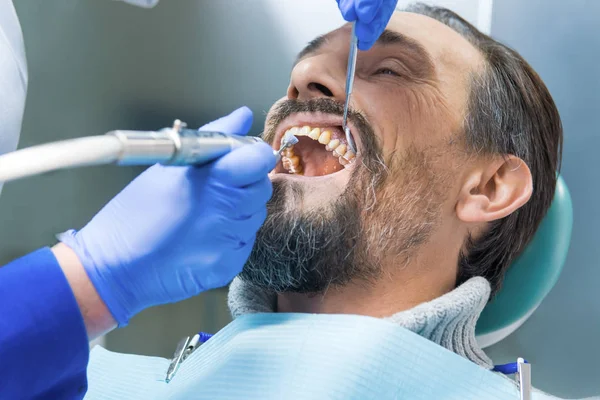 Tandläkare Rengör tänder. — Stockfoto