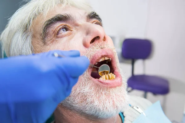 Senior man with bad teeth.