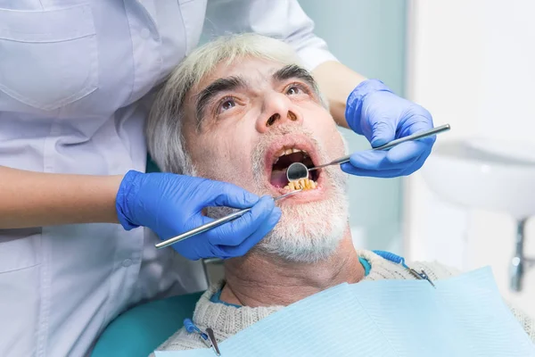 Starszy mężczyzna z zepsute zęby. — Zdjęcie stockowe