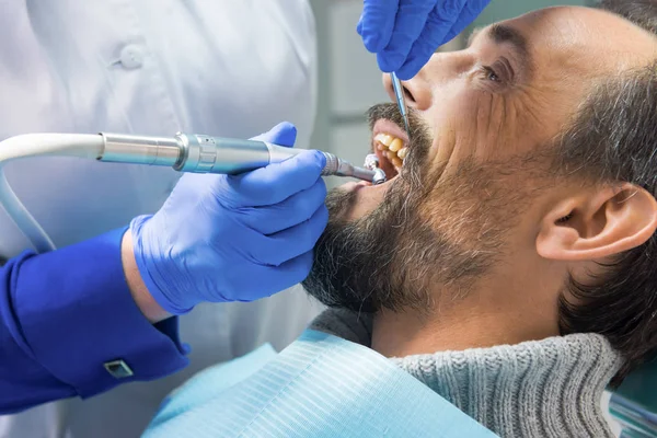 Dentista limpeza dos dentes . — Fotografia de Stock