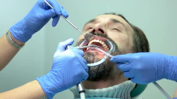 Пациент и руки стоматолога . — стоковое видео