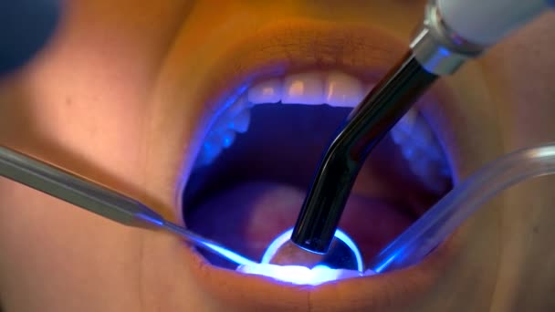 Dentala patienten och lampan. — Stockvideo