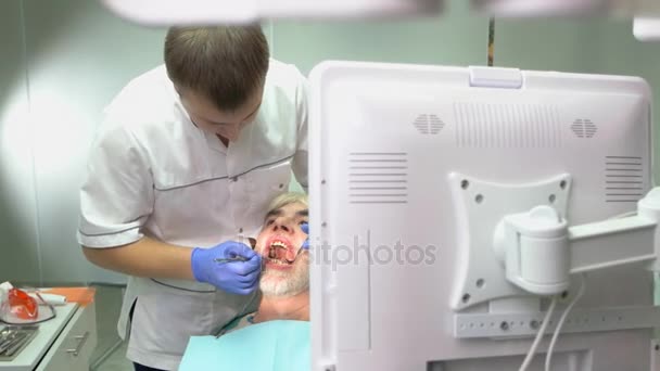 Dentist examining elderly patient. — Stock Video