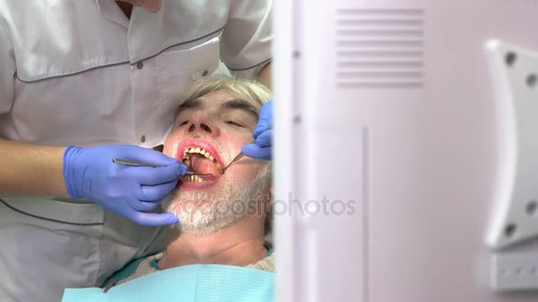 Pracy stomatologa, starszy pacjent. — Wideo stockowe