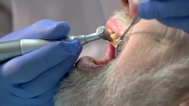 Стоматолог чистить зуби пацієнта . — стокове відео