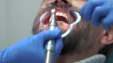 Diş hekimi diş fırçalamaya yakın çekim.