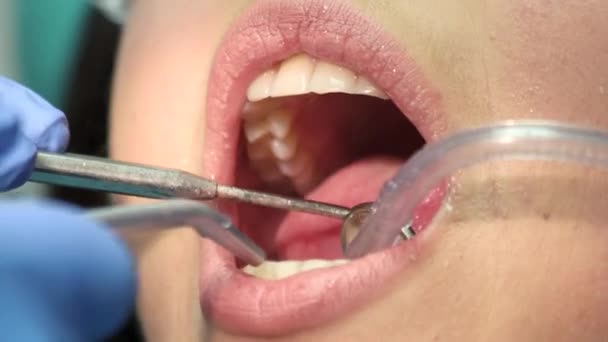 Geopende mond en tandheelkundige instrumenten. — Stockvideo