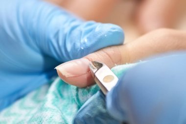 Manikürcü manikür istemciye kesti..