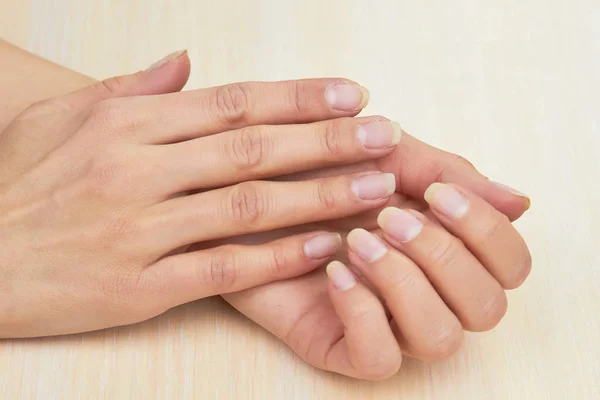 Manos femeninas sin barniz en las uñas . —  Fotos de Stock