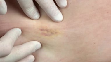 Doktorlar eldiven verip hastanın cildini kontrol ediyorlar..