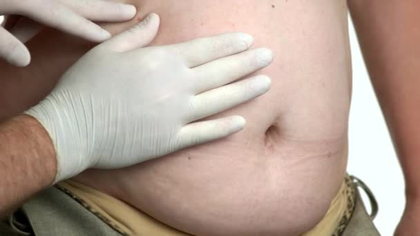 Médico examinando gran vientre de la mujer gorda . — Vídeo de stock