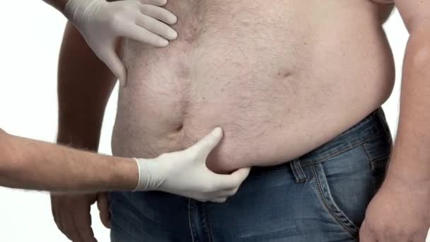 Az orvos egy kövér ember hasát vizsgálja.. — Stock videók