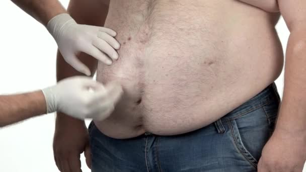 Doutor em luvas de borracha examinando a barriga do paciente gordo . — Vídeo de Stock