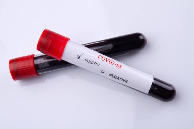 Beyaz arka planda iki kan testi tüpü..