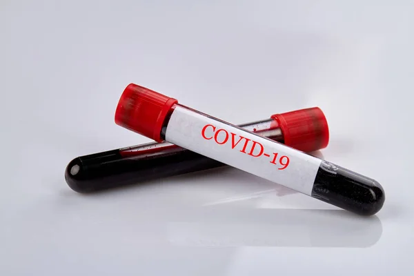 Blodprovsrör med COVID-19-virusprov. — Stockfoto