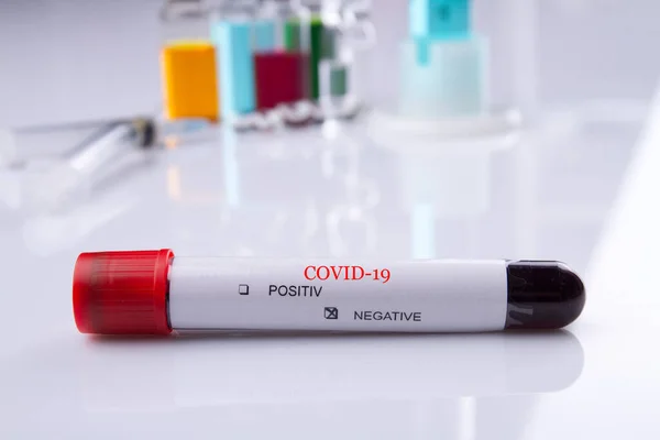 Coronavirus negativt blodprov. — Stockfoto