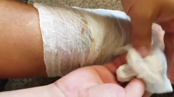 Una herida en la pierna de un hombre. Primeros auxilios — Vídeos de Stock