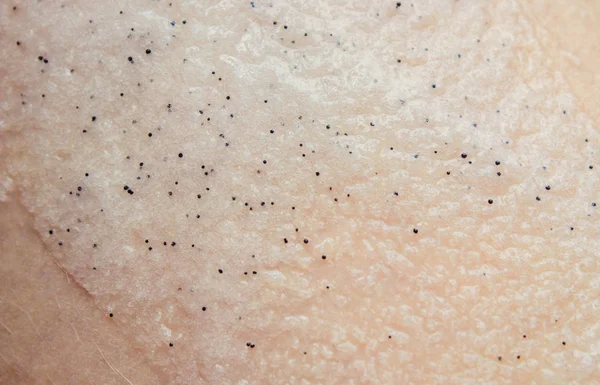 Body scrub with exfoliating particles. Selective focus. Closeup. — Stock Photo, Image