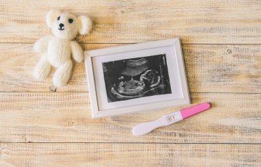 Bebeğin fotoğrafının ve aksesuarlarının ultrason fotoğrafı. Seçici odaklanma. çocuk.