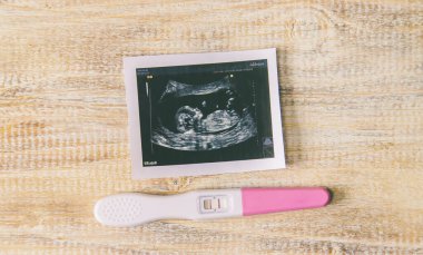 Bebeğin fotoğrafının ve aksesuarlarının ultrason fotoğrafı. Seçici odaklanma. çocuk.