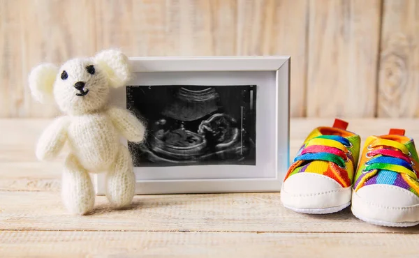 Imagen Ultrasonido Fotografía Accesorios Bebé Enfoque Selectivo Niño —  Fotos de Stock