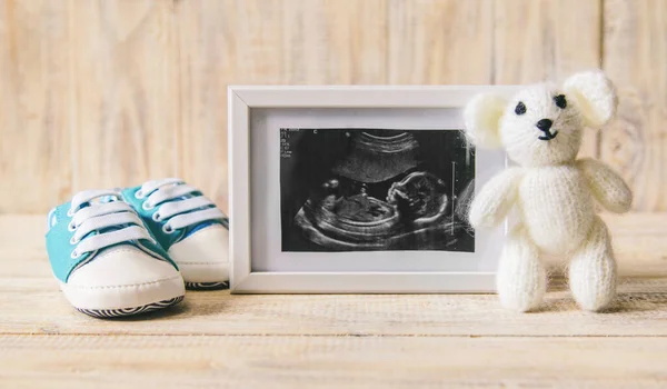 Imagen Ultrasonido Fotografía Accesorios Bebé Enfoque Selectivo Niño — Foto de Stock