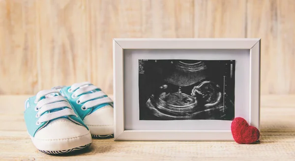 Immagine Ultrasuoni Della Fotografia Degli Accessori Bambino Concentrazione Selettiva Bambino — Foto Stock